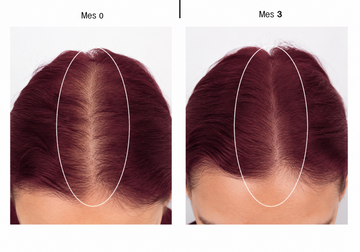Regenerador Bioactivo