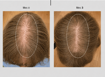 Regenerador Bioactivo